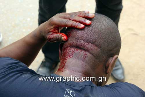 File image - An unidentified man tends to his injury sustained during the violence that broke out during the Ayawaso West Wuguon Constituency by-election on 31st January 2019.