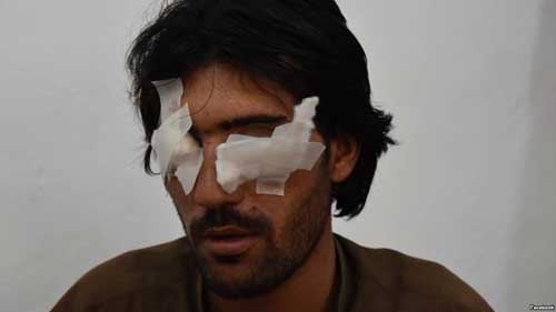 Abdul Baqi, 22, thought his family would help him get married. Instead, his father and four brothers accused him of violating Islamic values and removed his eyes to punish him. VOA photo